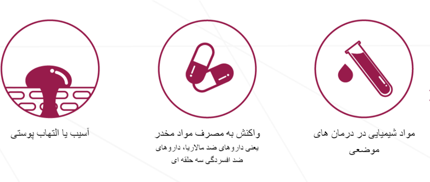 عوامل ایجاد هیپرپیگمنتیشن