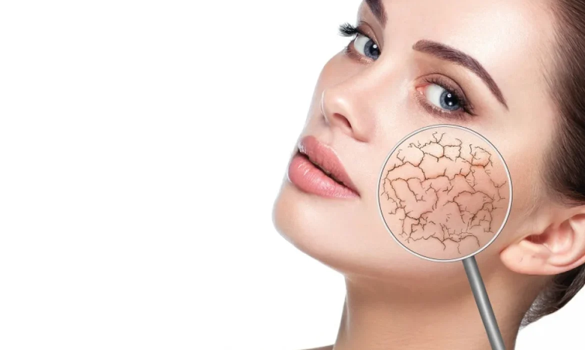 signs-of-dry-facial-skin