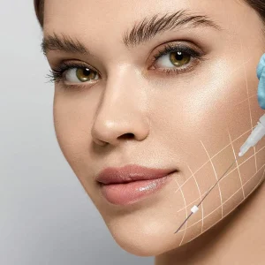 PDO-Thread-Lift-Eurolookmedspa