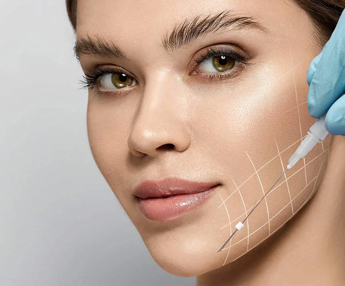 PDO-Thread-Lift-Eurolookmedspa